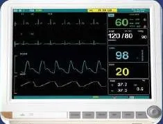 Monitor multiparámetro con signos vitales